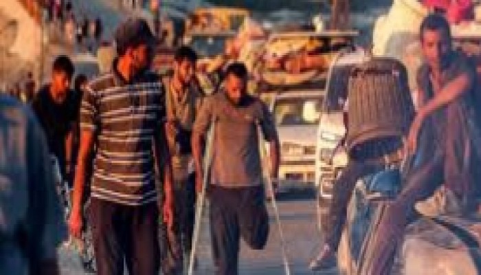 গাজায় ১০ হাজারের বেশি শিশু চিরস্থায়ী শারীরিক ক্ষতির শিকার গাজায় ১০ হাজারের বেশি শিশু চিরস্থায়ী শারীরিক ক্ষতির শিকার