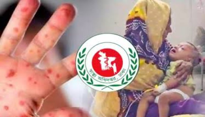 হাম উপসর্গে সুনামগঞ্জের আরো ৩ শিশুর মৃত্যু