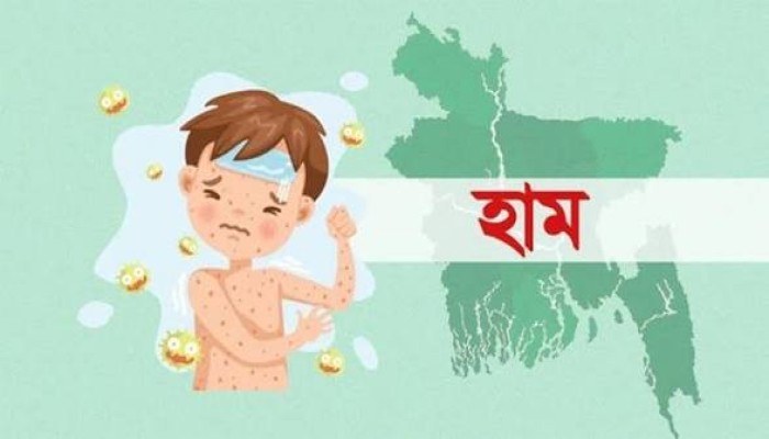 হামের উপসর্গে আরও ৭ জনের মৃত্যু