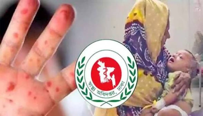 হাম উপসর্গে ৬ জনের মৃত্যু