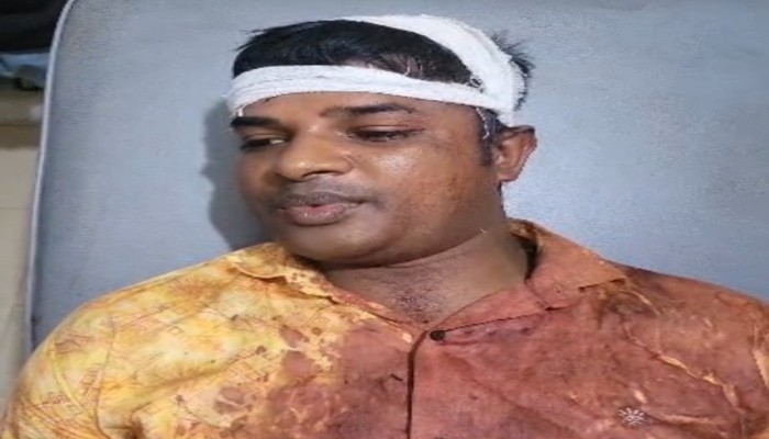 ভূমি দখলে বাধা দেওয়ায় শিক্ষককে কোপাল দখলবাজরা
